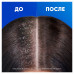 Шампунь и бальзам-ополаскиватель 2в1 Head&Shoulders Основной уход против перхоти 400 мл